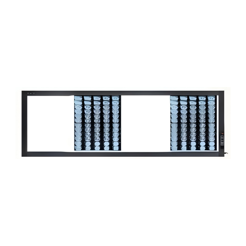 X RAY Film Viewer RAD-FV4A