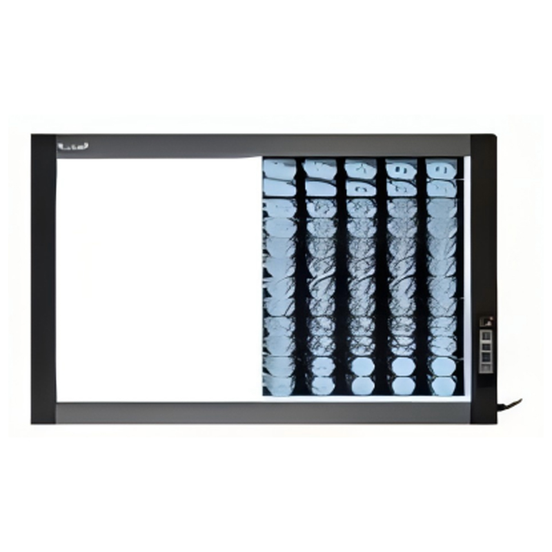 X RAY Film Viewer RAD-FV2A