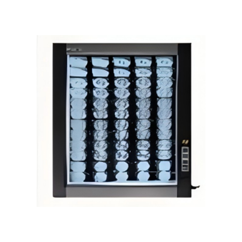 X RAY Film Viewer RAD-FV1A