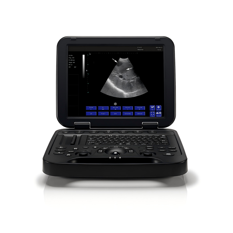 Ultrasound System RAD-US06