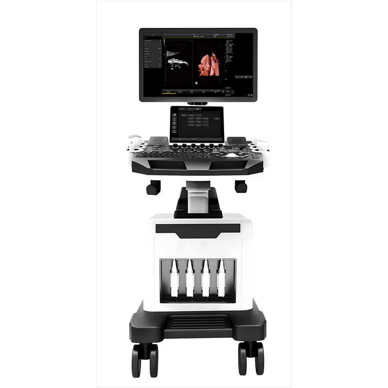 Ultrasound System RAD-US01